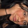 abidanette