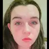 arsonistpotato1