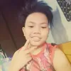 dendenkulit.burn