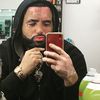 vitiligoking23
