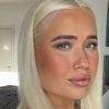 blondinalkin