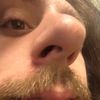 1urdadsleftnutsack1