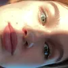 bekrela