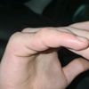 finger35536