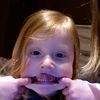 blakealix