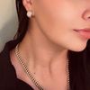 alondralz01