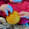 leben_mit_dysmelie