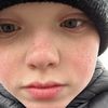 aaronsbaldhead