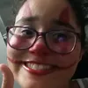 anateiteicontareserva