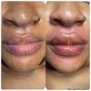 gavenchi_beautyclinic