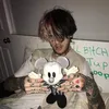 brokenbonesssssss
