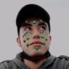suso_rs1