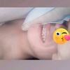 damianalmuna1