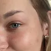kristenteg