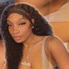 thevitiligo_mami