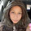 alopecia_mommy