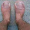sendthemtoes