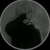 zoml3ie