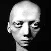 microsazbototocele
