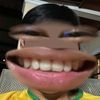 fewx_45