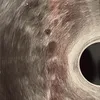 marttmiau