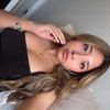 ashyelbows_