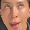 monchichifever