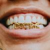 grillz_and_teeth