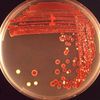 serratia.marcescens