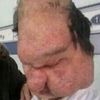 baldman23