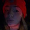 skyebivs