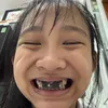 phklingggg