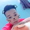 31209764665