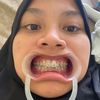 dwi_ilr