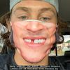 zachpp12