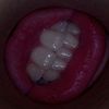herpeys_freesince03