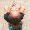 felo_melanin
