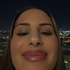 zoii_g