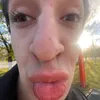 mortxlis