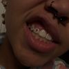trippinoverz_