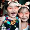 epe_thysa