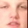 cdhurt4