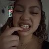 .skittllezz