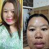 korbanskincareviral