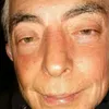 bacoidaneri