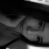 amyloiss