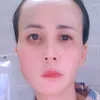 tuyetlongmi