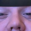 doclagmd15