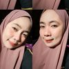 me141414