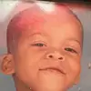 dudethehugh